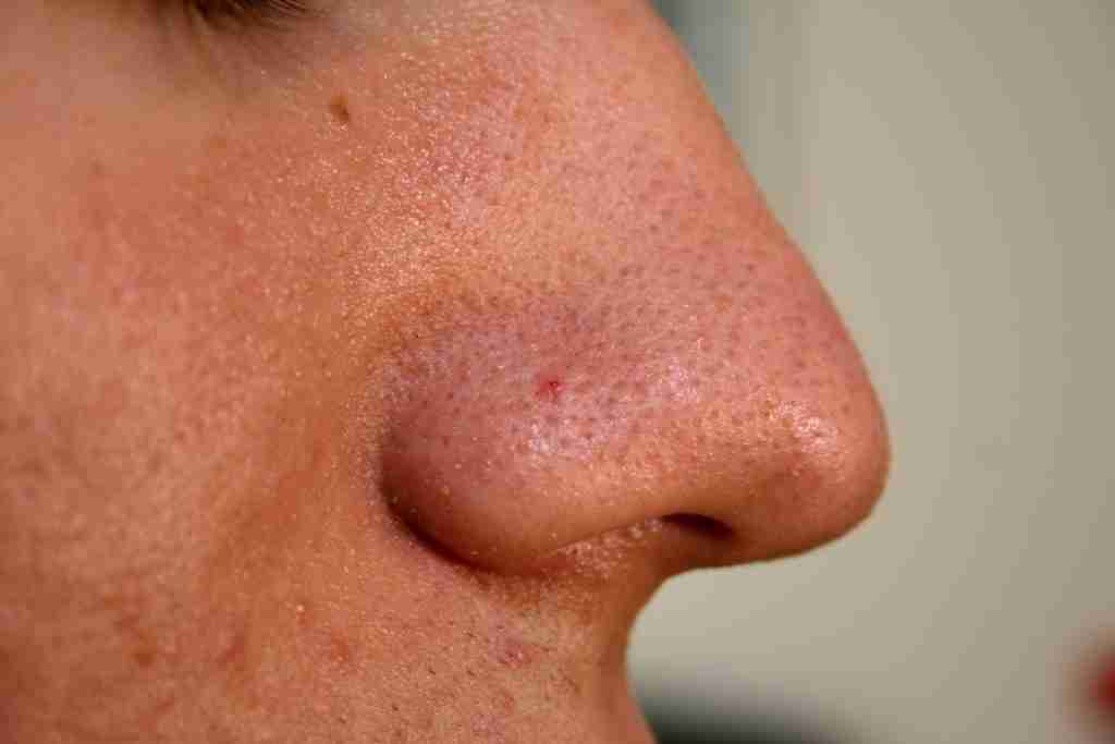 Human Nose